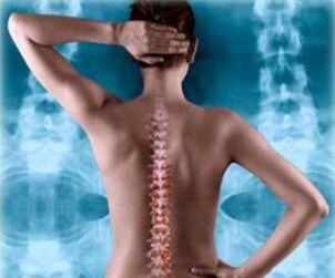 ilustrim i shtyllës kurrizore