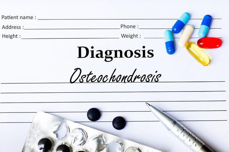 Medikamente për diagnostikimin e osteokondrozës