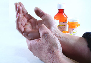 metodat e trajtimit të artritit dhe artrozës