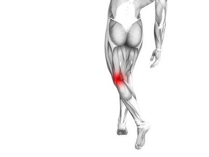 Osteoartriti i kyçit të gjurit