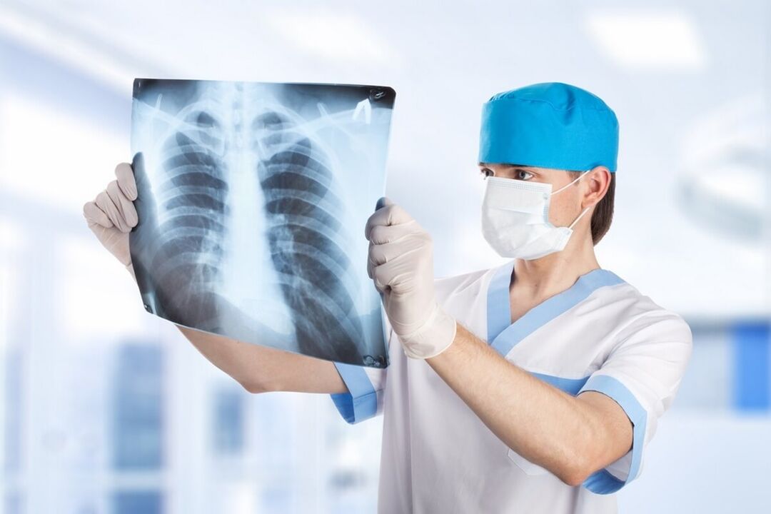 X-ray e gjoksit me osteokondrozë