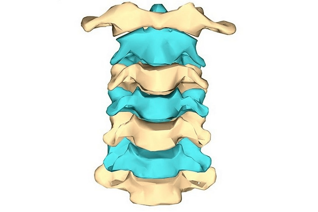 fazat e osteokondrozës së qafës së mitrës